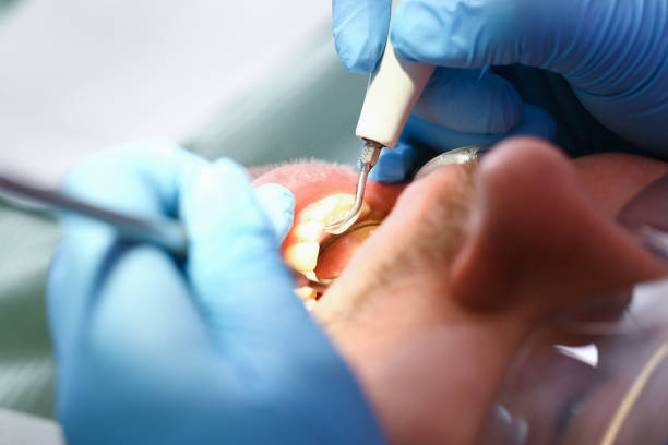 Best Emergency Denture Repair in Tenaha, TX