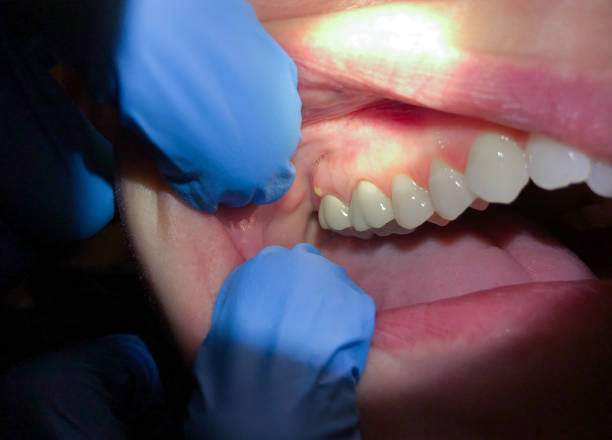 Best Same-Day Emergency Dental Services in Tenaha, TX