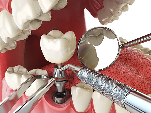 Best Emergency TMJ Treatment in Tenaha, TX