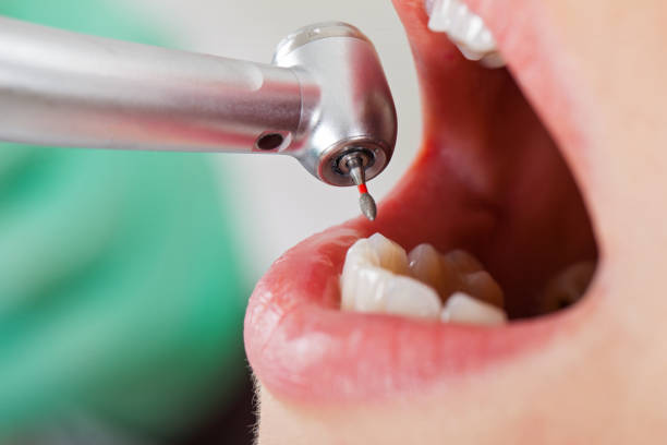 Best Same-Day Emergency Dental Services in Tenaha, TX
